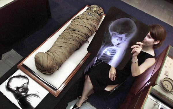 历史上的1月5日：伦琴发现X射线