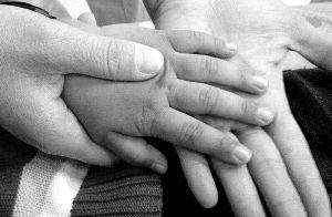 亚硝酸盐中毒的孩子，皮肤呈现青紫色。