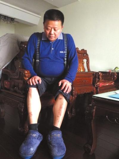 乡村医生获罪入狱申冤30年 两度获刑两度平反