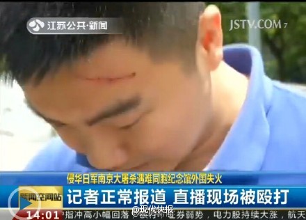 记者正常报道火灾遭殴打 全身多处严重划伤