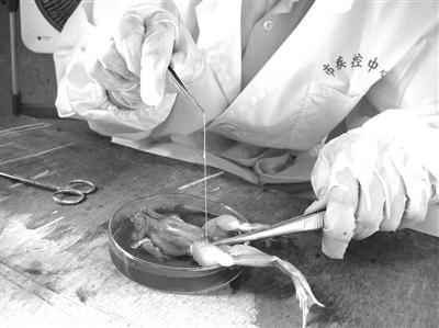 12岁女孩脑子里取出20厘米长寄生虫