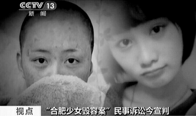 “合肥少女毁容案”周岩获赔170多万周家不满意