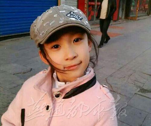 9岁女孩冲入火海救姥姥 全身65%重度烧伤(图)