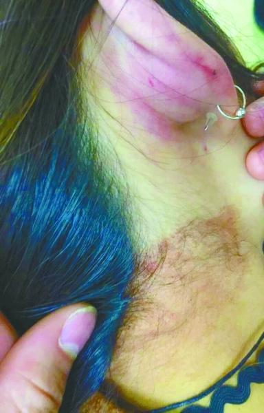 女大学生拒绝陌生男子搭讪 被堵路遭酒瓶破头