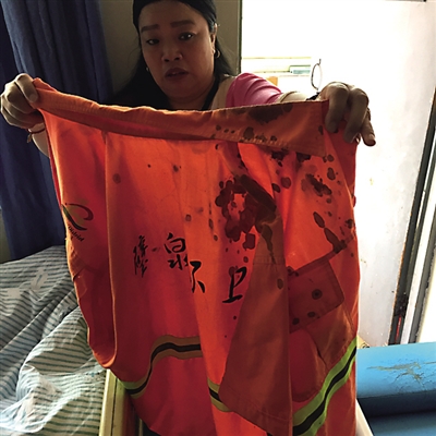 工作服上满是鲜血。