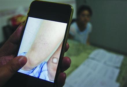 15岁女生遭5名同学欺凌:化丑妆烟灰烫罚跪地