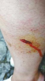 女游客在峨眉山景区遇猴子夺包 腿被连咬两口