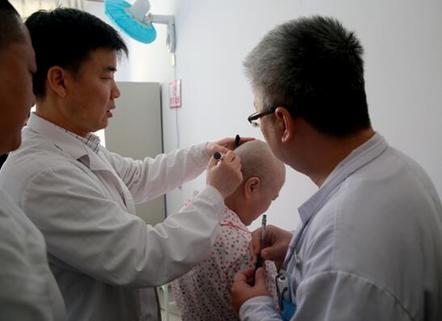 一台天坛标准的神经外科手术