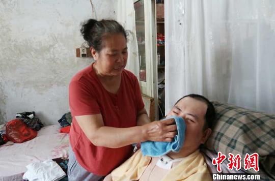 每次喂完食物后,梁青兰都要仔细地帮儿子清理干净。 尚明侠 摄