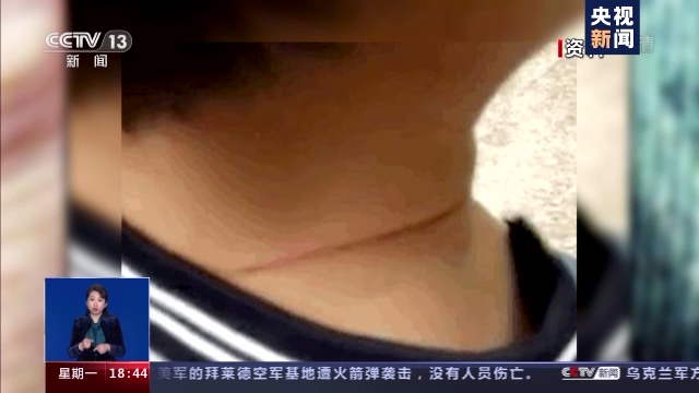 风筝轻飘飘风筝线如何伤人于无形?一旦被风筝缠上了该怎么办呢?