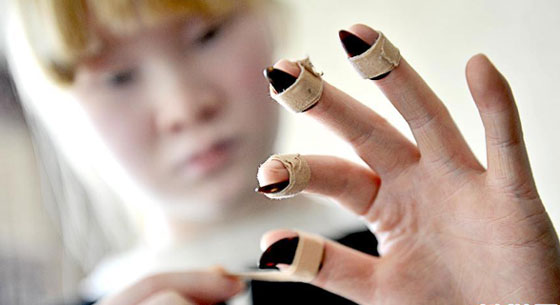 图片故事：白化病女孩的艺术梦