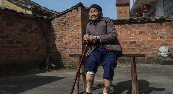 难以愈合的伤痛：寻访侵华日军细菌战幸存者