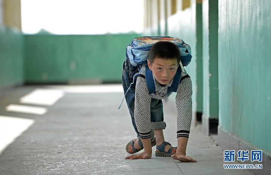 蜗牛男孩&rdquo;艰辛上学路