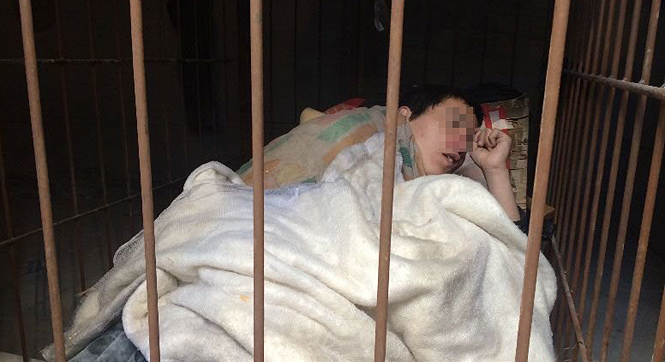陕西26岁小伙患精神病 家人将其关铁笼