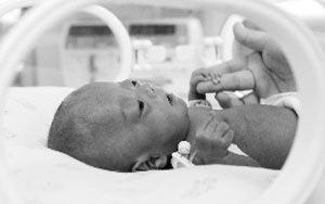 近50岁妈妈早产“拇指姑娘”：手掌仅指甲大小