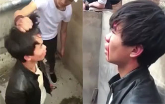 男生厕所被殴 头被踩进粪坑血流满面