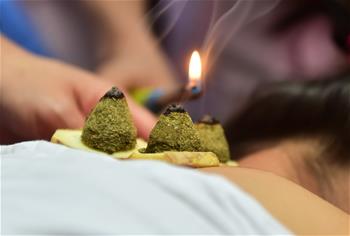 冬病夏治&ldquo;三伏灸&rdquo;深受市民喜爱