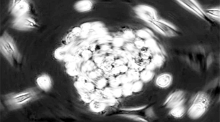 美国科学家借癌细胞增生能力修复小鼠受损心脏