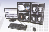 医疗影像信息软件系统