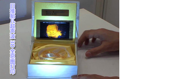 日推出胎儿超声波3D全息图打印术(组图)