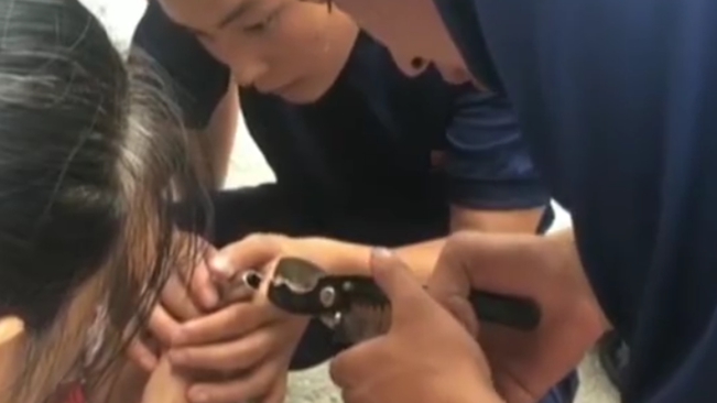 河南南陽：女孩拇指卡鋼套 消防成功救助