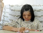 福建首例换脸手术成功 少女对镜微笑