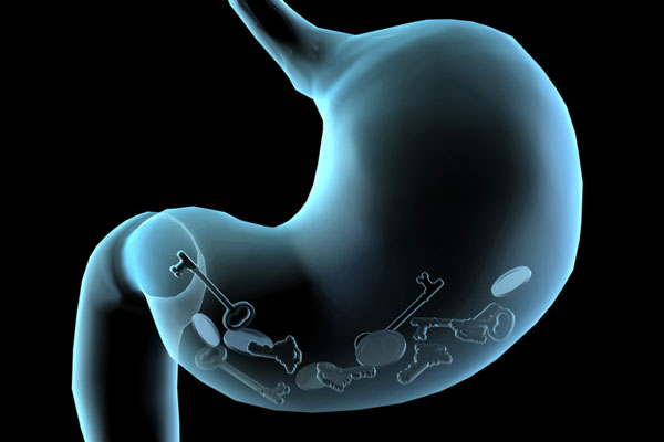 【健康解码】微创外科手术适用于治疗胃癌吗？