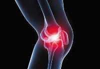 【健康解碼】健康的膝關節到底長什麼樣？