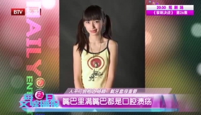 人不可貌相之楊穎：戴牙套很重要