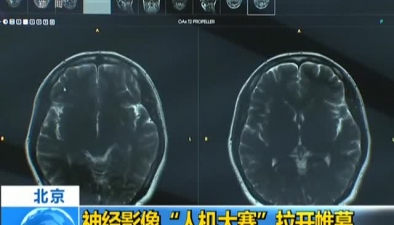 北京：神经影像“人机大赛”拉开帷幕