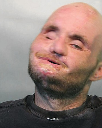 美国男子持刀伤人反被打破相被称最丑犯人（图）