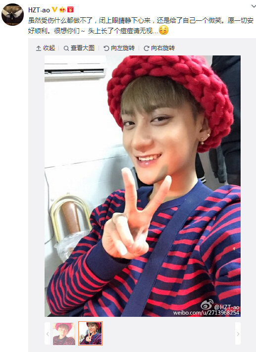 EXO黄子韬受伤后晒萌照对镜头微笑比剪刀手(图)