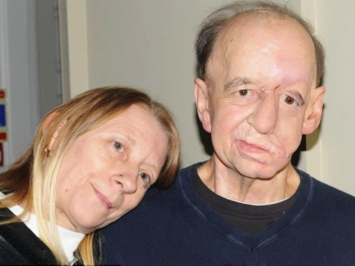 资料图片：3D打印技术可帮助重建面部。