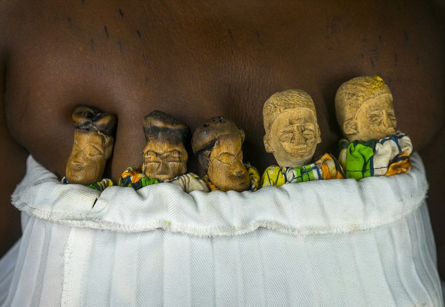 在西非的一个部落中,婴儿死亡率极高,总有孩子因患疟疾等疾病而