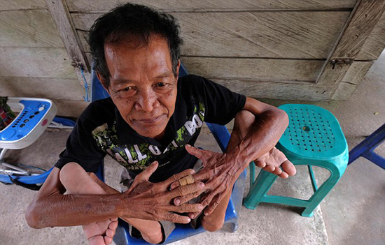 组图：印尼68岁老人展现惊人柔身术 摆&ldquo;烤火鸡&rdquo;造型 