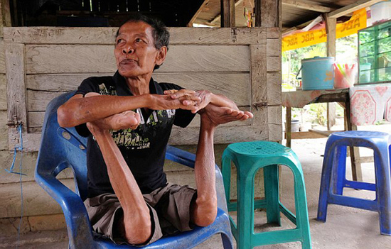 组图：印尼68岁老人展现惊人柔身术 摆&ldquo;烤火鸡&rdquo;造型 