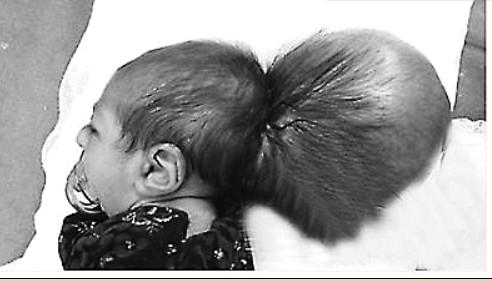 孟加拉国再现双头婴儿引围观 盘点全球双头婴事件(图)