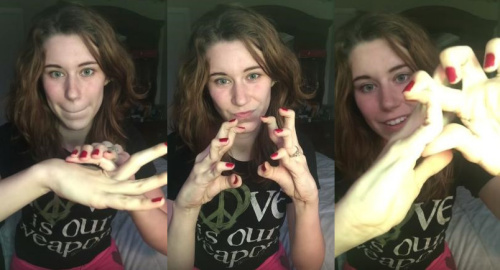 女子患罕见疾病关节柔软手指可反折贴上手背(图)