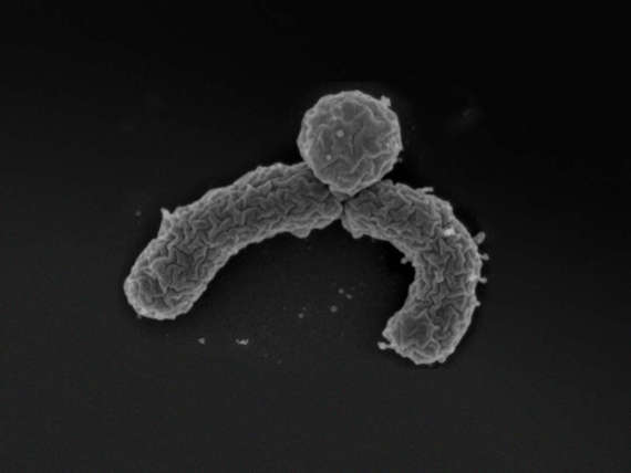 速来围观！那些即将上市的&ldquo;救命&rdquo;科技产品