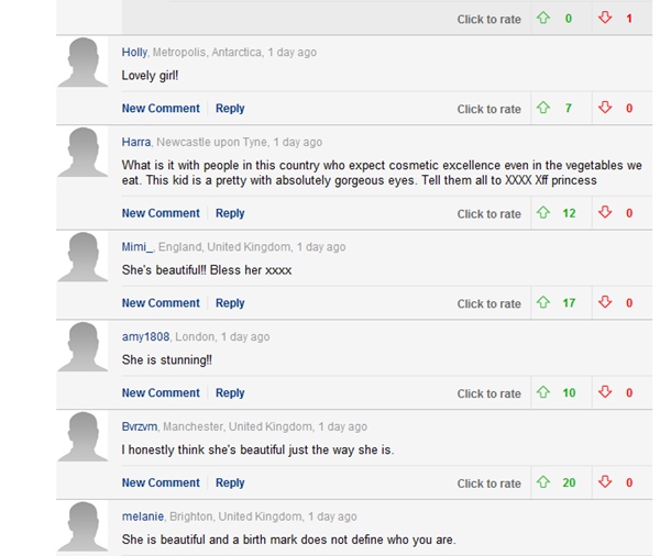 勇敢又美丽！英&ldquo;胎记女孩&rdquo;晒素颜自拍获十万网友点赞