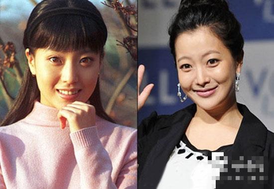 金喜善多年整容变不老女神：