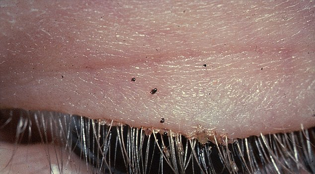 英媒盘点2015年五大最恶心画面