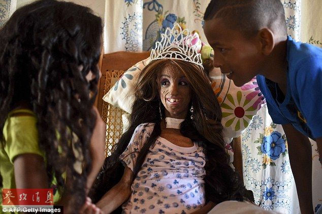 &ldquo;度日如年&rdquo;！罕见早衰症女孩庆祝15岁生日