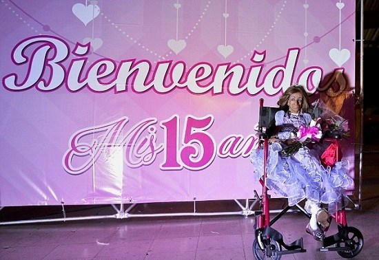 患衰老症女孩度过15岁生日相貌像90岁老人（图）