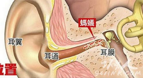 组图：女孩耳朵成蚁穴 每天至少爬出10到15只 