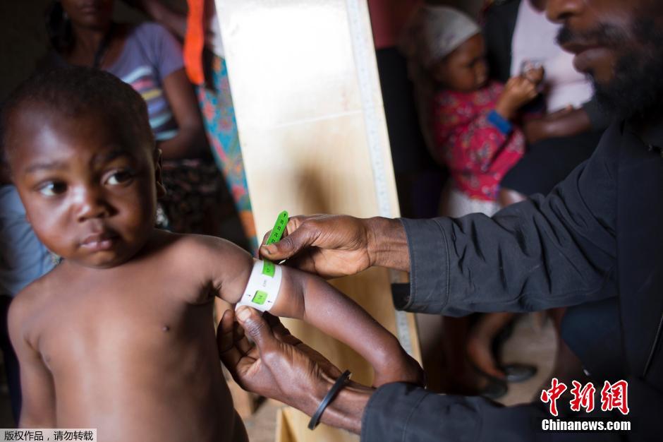 厄尔尼诺加剧海地旱情 饥荒造成大批儿童营养不良