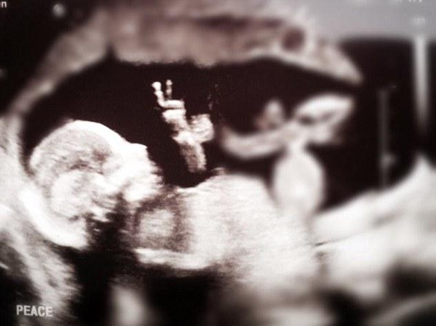 美国一孕妇B超发现腹中胎儿摆V字手势走红网