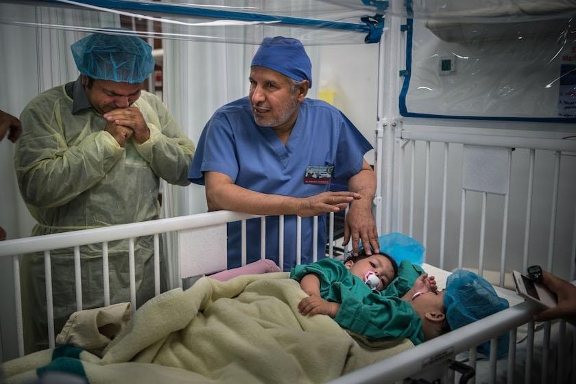 重获新生：巴基斯坦连体婴儿成功分离