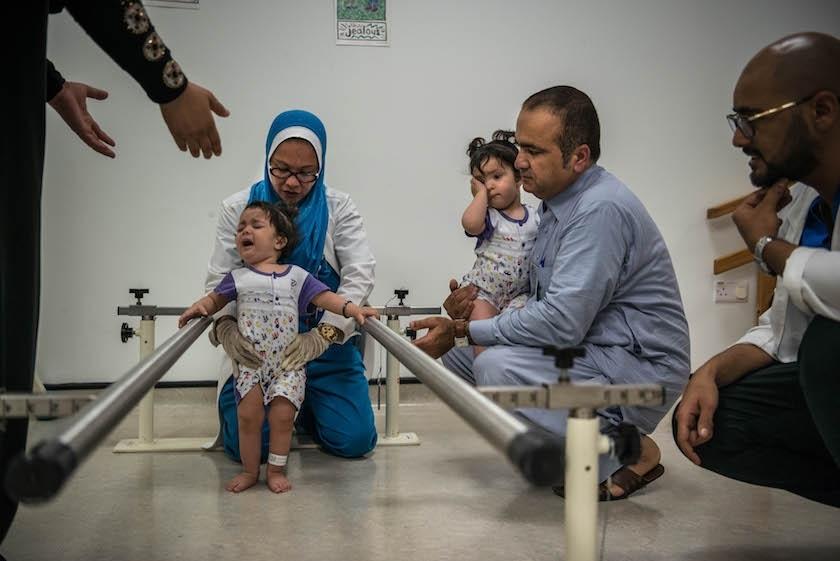 重获新生：巴基斯坦连体婴儿成功分离