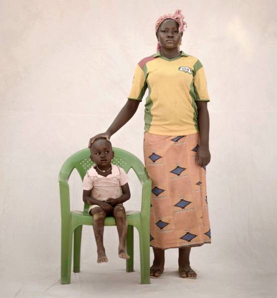 未成年少女妈妈故事：200万女孩15岁以前生孩子